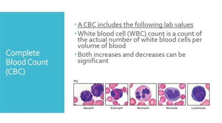 Diff -b and -w difference